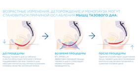 Почему не используют точку у в Black Star Wear